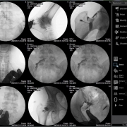 x-ray Purchase Checklist