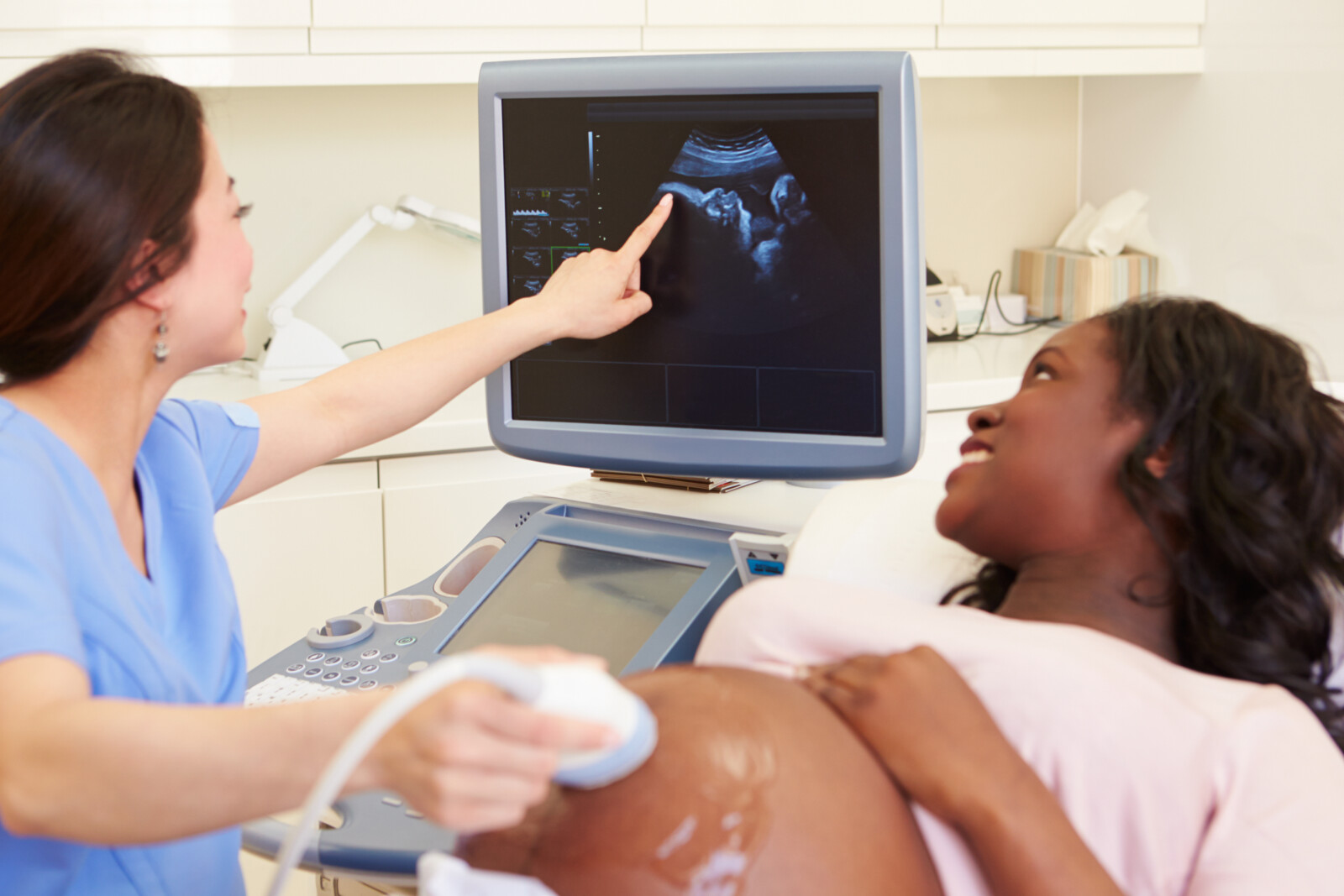 4D Ultrasound machine