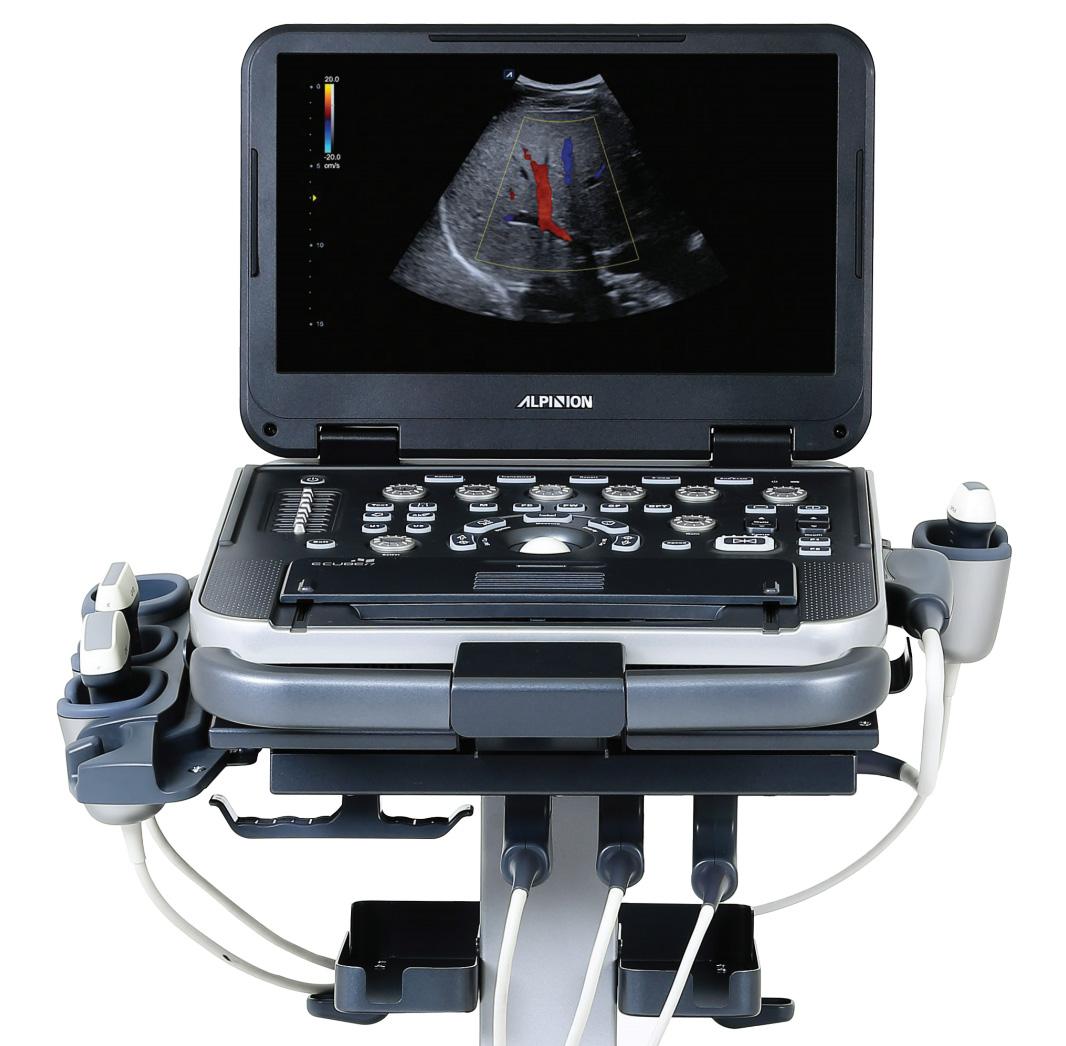 Affordable Ultrasounds