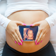 3D ultrasound machine