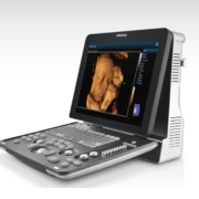 3D and 4D Ultrasounds