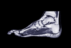 Podiatry MRI